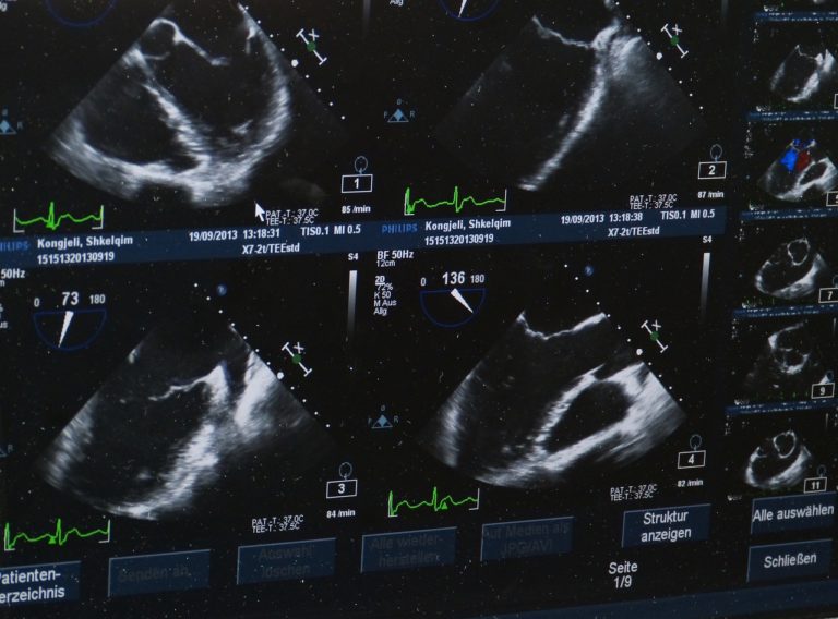 Doppler tętnic szyjnych i domózgowych: nowoczesne narzędzie diagnostyczne w medycynie